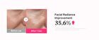 PDRN Collagen Glow Jelly Serum - 30ml