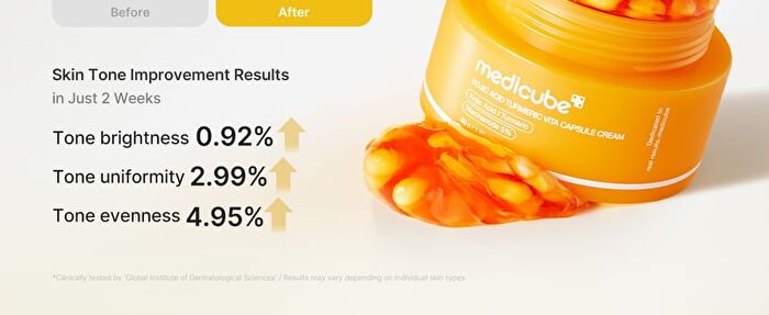 Kojic Acid Turmeric Vita Capsule Cream - 53g