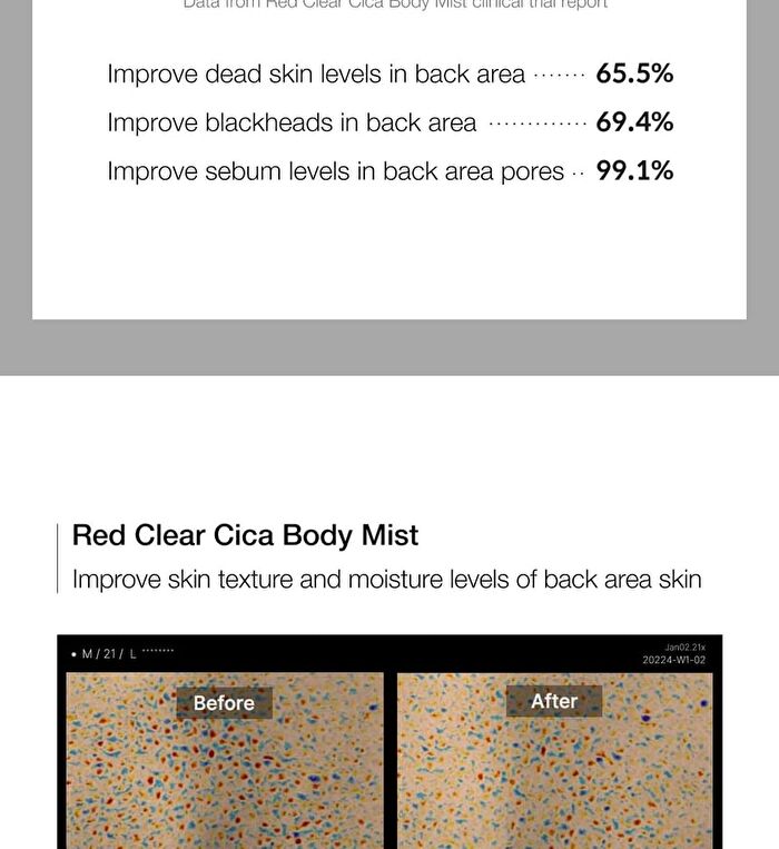 Red Clear Cica Body Mist (EU/UK Packaging) - 200ml