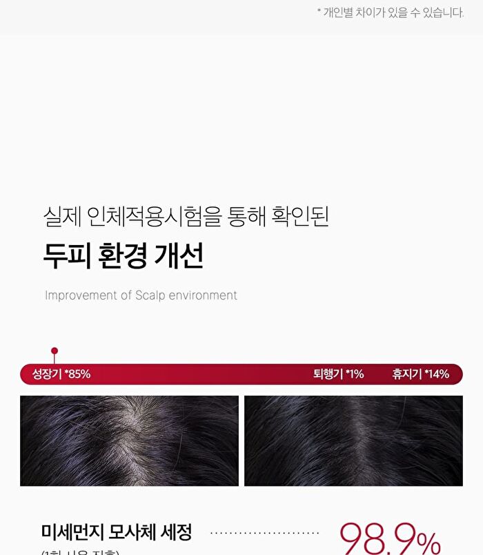 Soyxidil Shampoo (EU/UK Packaging) - 490ml