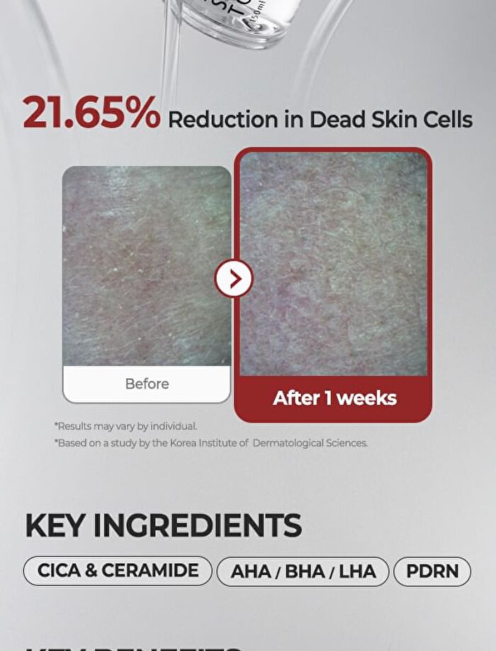 SKIN Scaling Toner - 150ml
