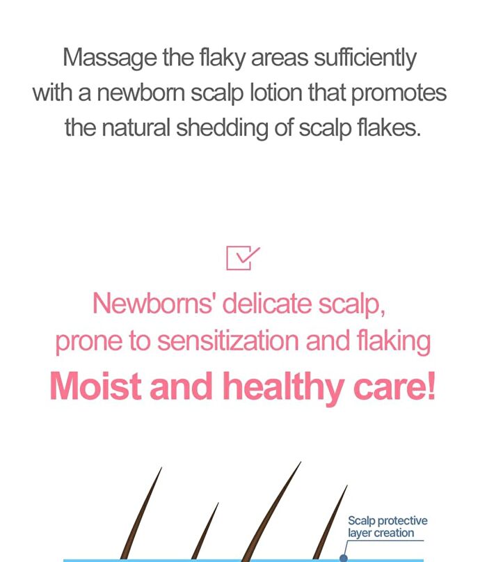 Newborn Scalp Lotion - 100g