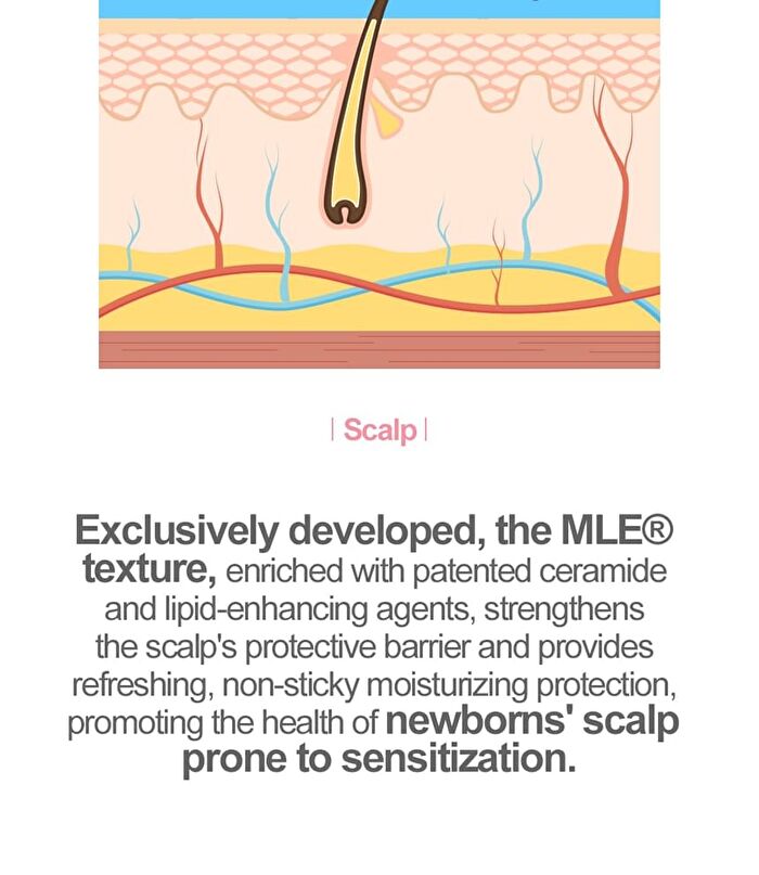 Newborn Scalp Lotion - 100g