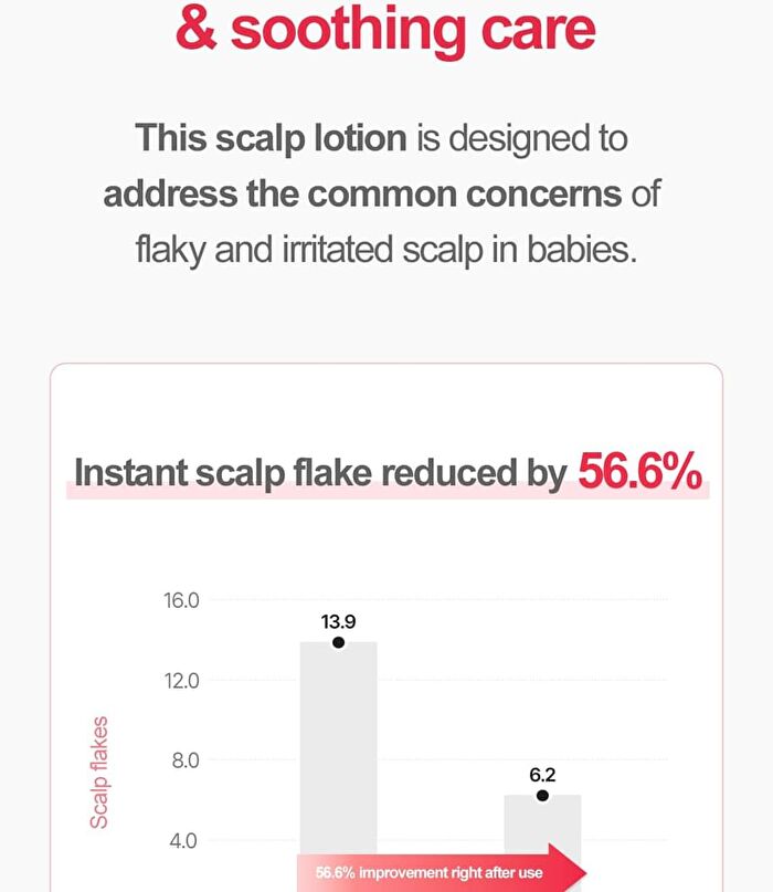 Newborn Scalp Lotion - 100g