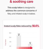 Newborn Scalp Lotion - 100g