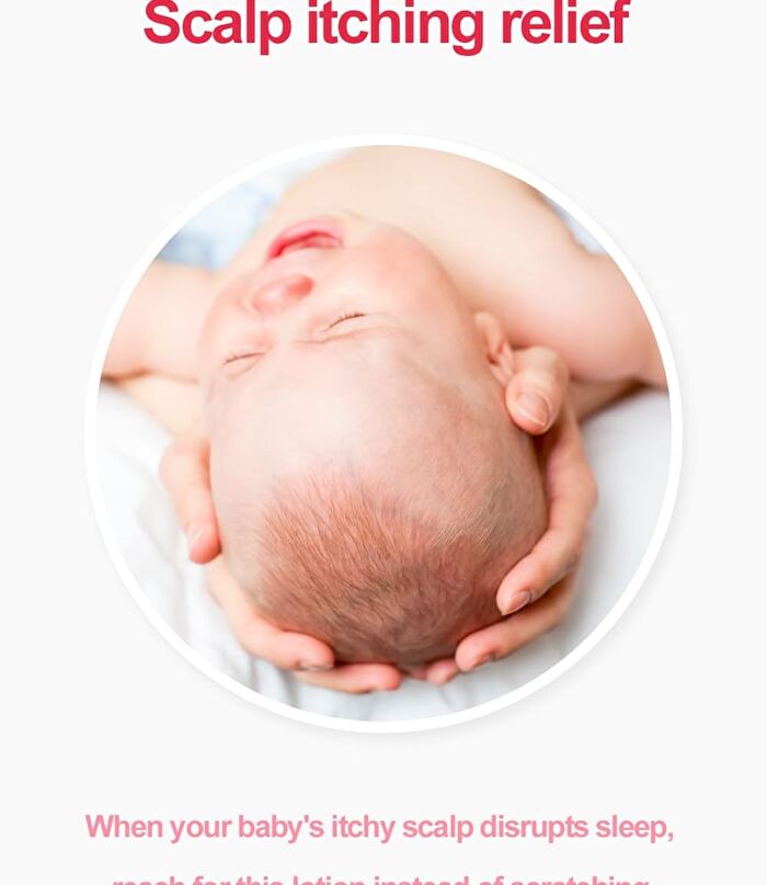 Newborn Scalp Lotion - 100g