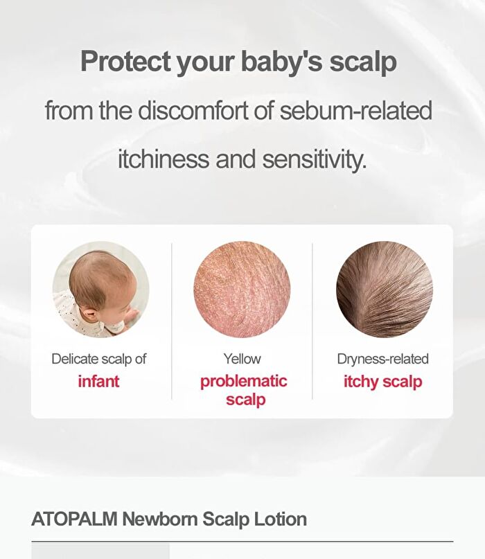 Newborn Scalp Lotion - 100g