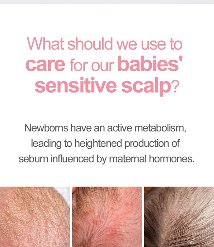 Newborn Scalp Lotion - 100g