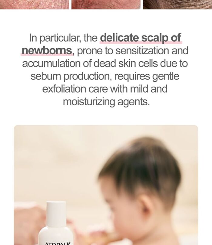Newborn Scalp Lotion - 100g