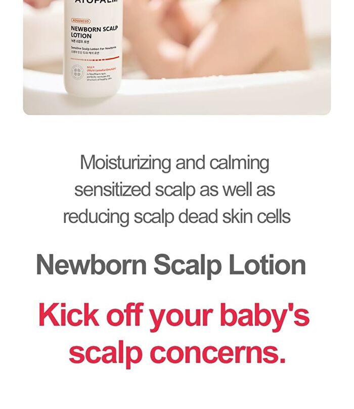 Newborn Scalp Lotion - 100g