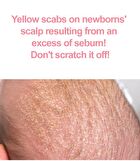 Newborn Scalp Lotion - 100g