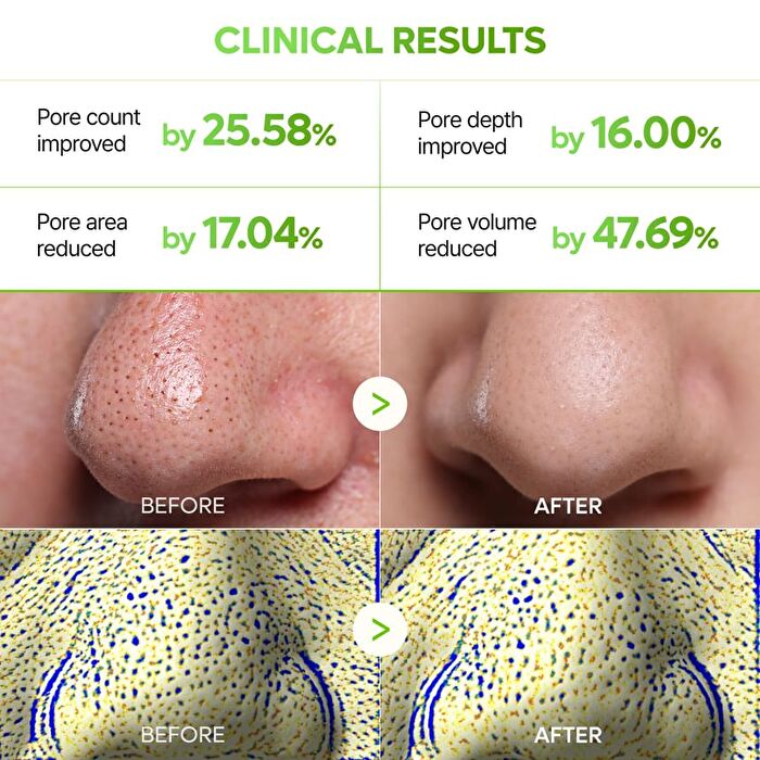 Cactox 3-Step Nose Pore Pack Set - 3 pcs