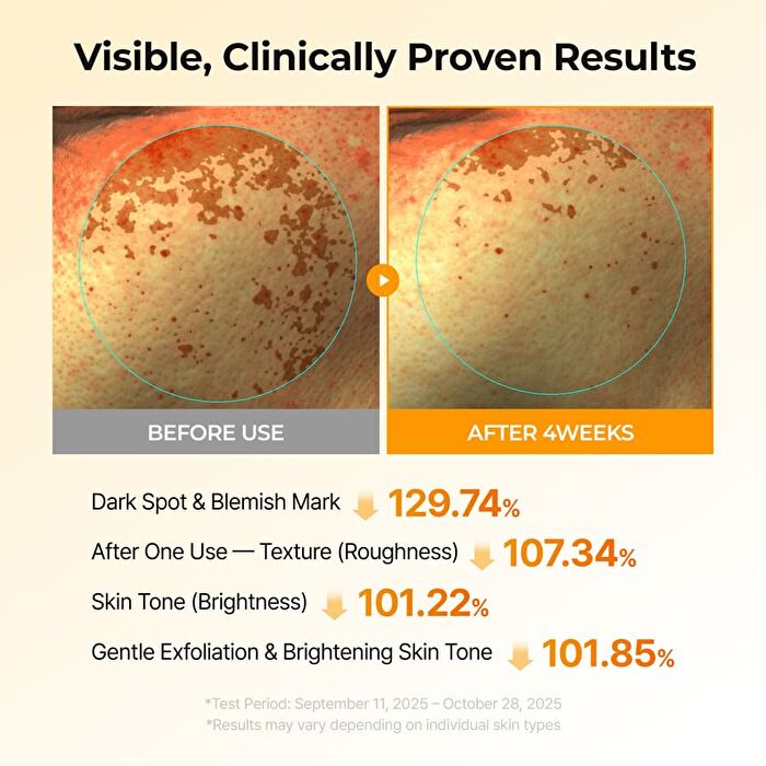 TX-Kojic Acid Turmeric Toner Pad - 70 Pads