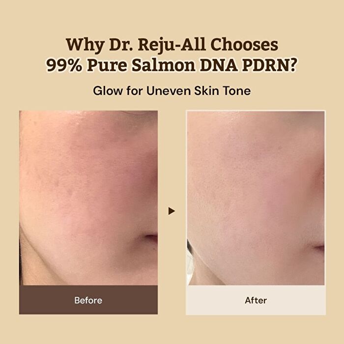 Dr.Reju-All Advanced PDRN Rejuvenating Cream Max - 60ml