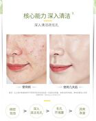 Franic Refreshing Foam Cleanser - 120g