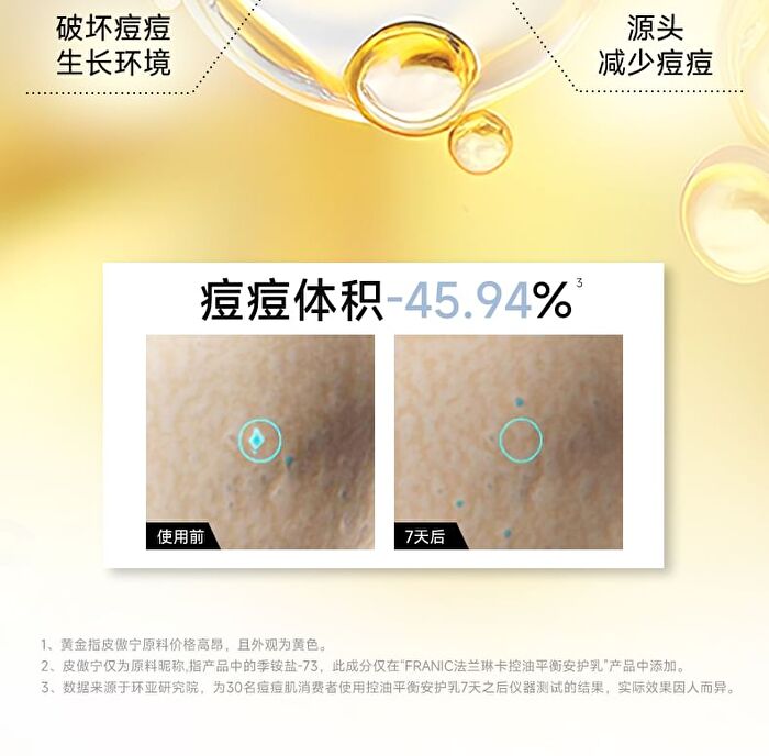 Franic Oil Control Balancing Lotion - 100g