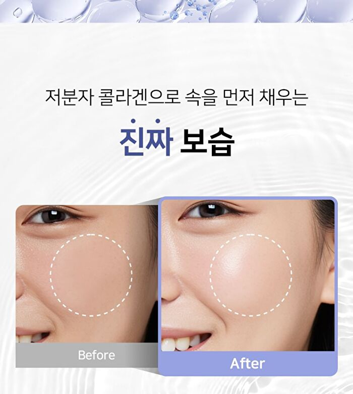Ootd Collagen Lifting Hydrogel Mask Set - 30g x 5 sheets
