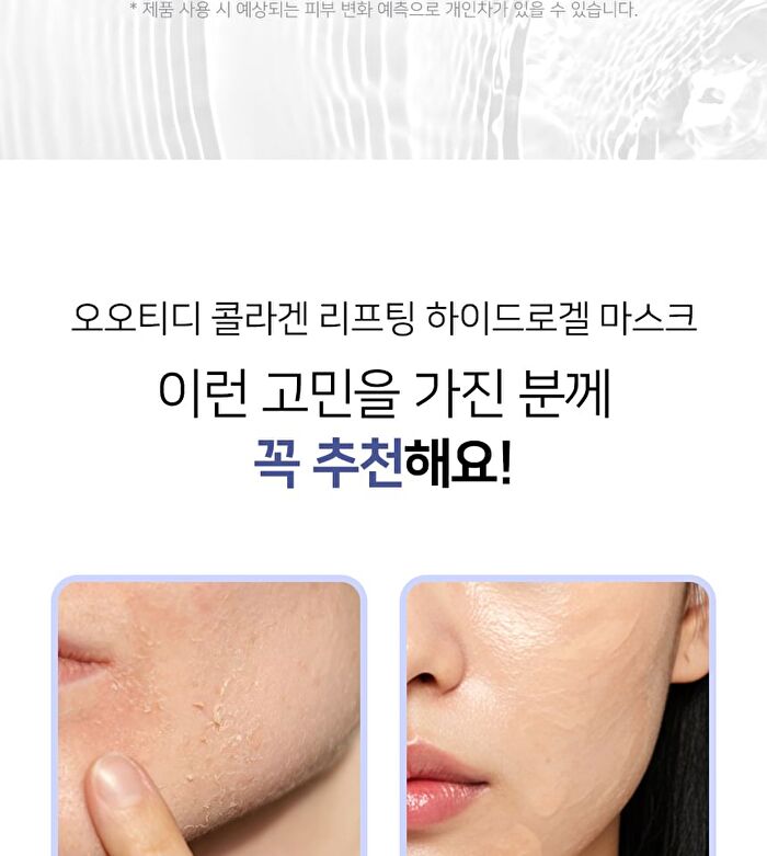 Ootd Collagen Lifting Hydrogel Mask Set - 30g x 5 sheets