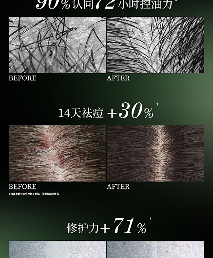 Oil-Control Volumizing Balancing Shampoo - 400g