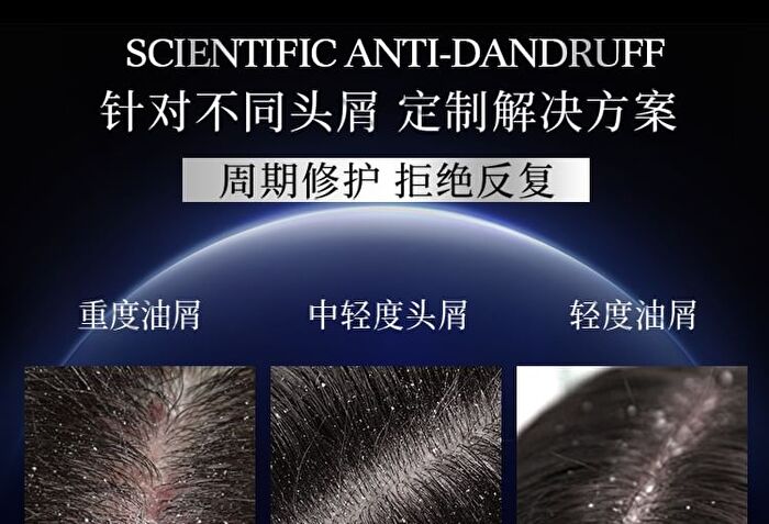 Anti-Dandruff Soothing Balancing Shampoo - 400g