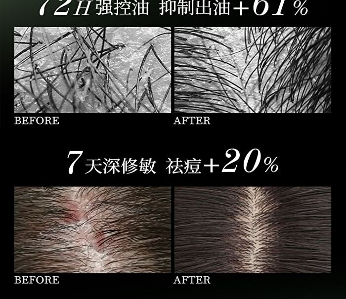 Scalp Soothing Intensive Treatment Essence - 100g