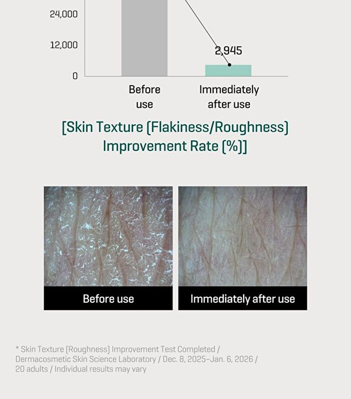 AHA, BHA, PHA Miracle Body Toner Mist - 140ml