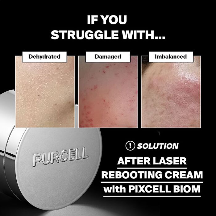 Pixcell Biom 5+ Probiotics Rebooting Cream - 2026 Version - 50ml