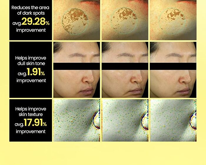 Lemon C Glutathione Brightening Pad - 70 pads