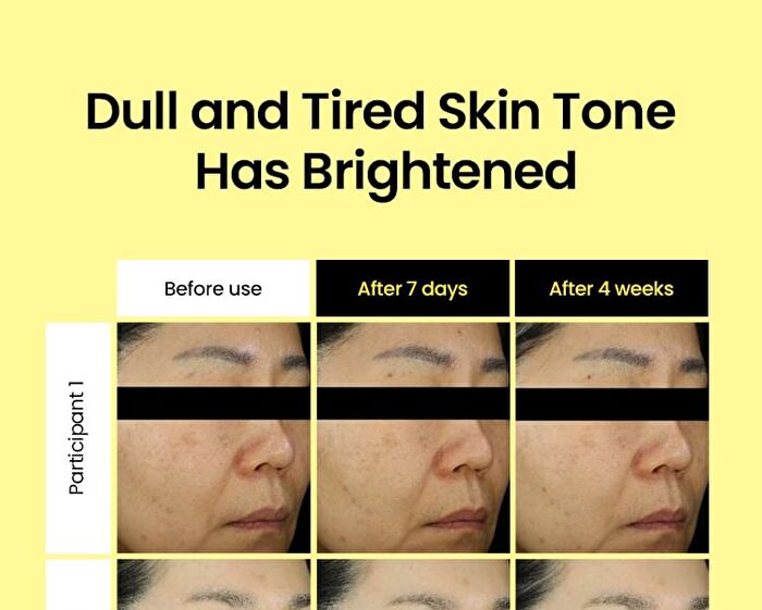 Lemon C Glutathione Brightening Pad - 70 pads