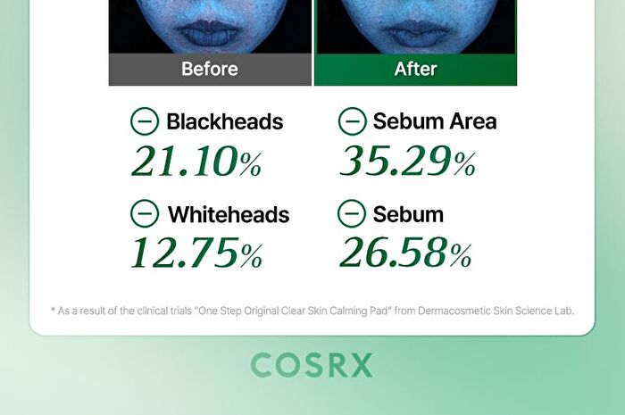 Cosrx One Step Original Clear Skin Calming Pad - 100 pads