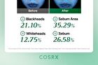 Cosrx One Step Original Clear Skin Calming Pad - 100 pads