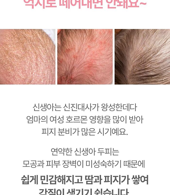 Newborn Scalp Shampoo - 300ml
