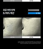 Clear Pro - 2026 Version - 1 Set