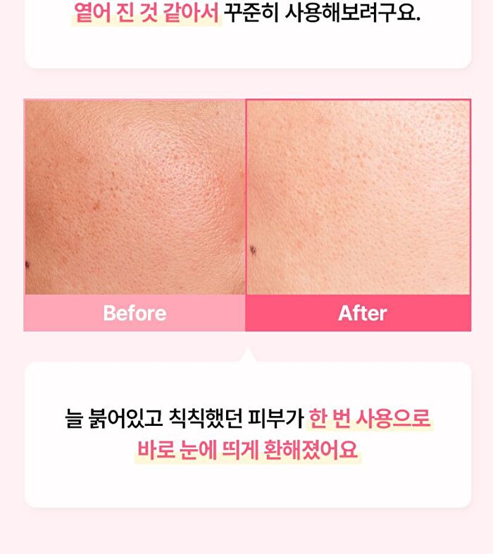 Re:dence Tone & Spot Perfect Glow Mask Set - 25ml x 10 sheets