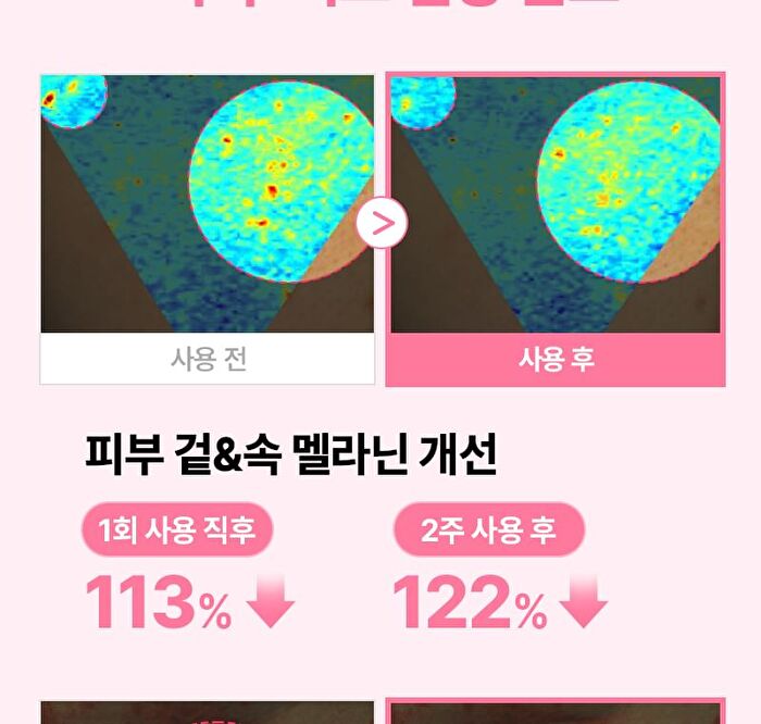 Re:dence Tone & Spot Perfect Glow Mask Set - 25ml x 10 sheets