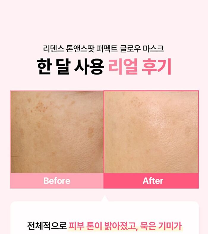Re:dence Tone & Spot Perfect Glow Mask Set - 25ml x 10 sheets