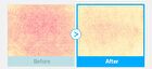 Re:dence Hyaluron Cool Soothing Mask Set - 25ml x 10 sheets