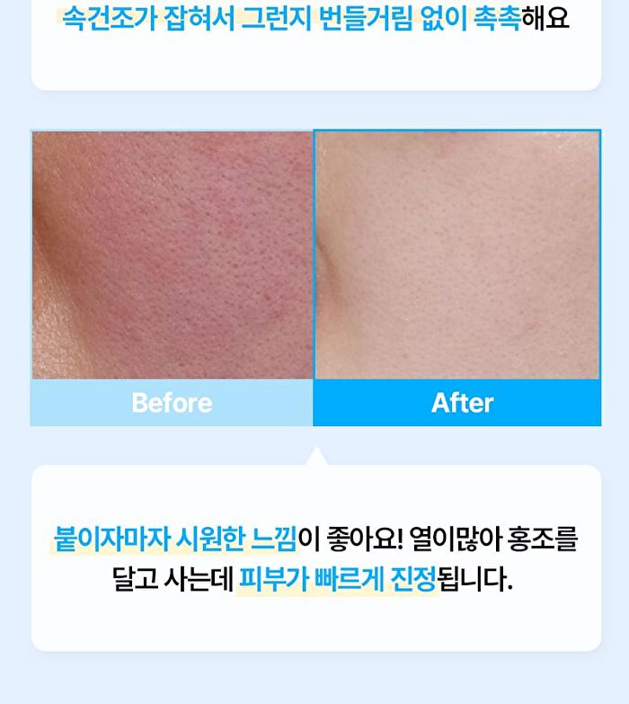 Re:dence Hyaluron Cool Soothing Mask Set - 25ml x 10 sheets