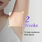 Vita Capsule Niacinamide 5 Percent Brightening Body Lotion - 300g