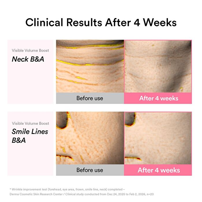 PDRN Volume Fill-it Booster Crème 2.5 Tube - 30ml