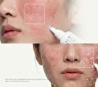 Active PDRN 50000 Rejuvenating Cream - 20g
