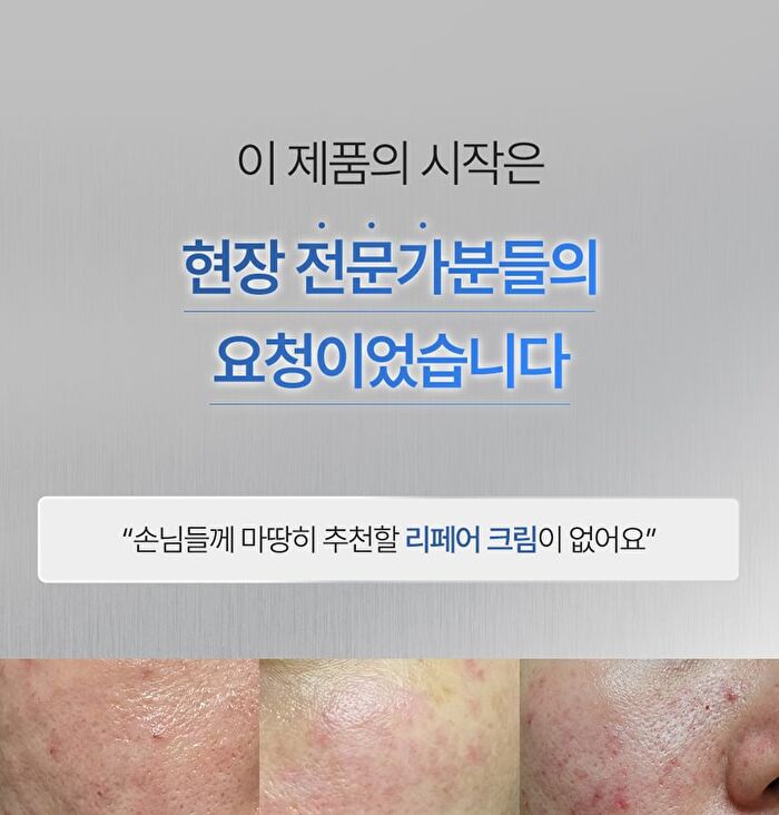 Active PDRN 50000 Rejuvenating Cream - 20g