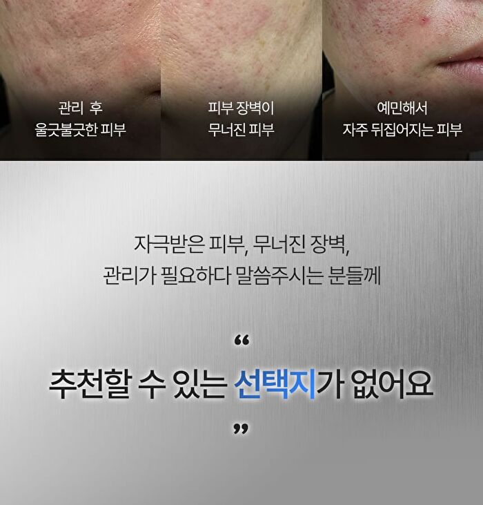 Active PDRN 50000 Rejuvenating Cream - 20g