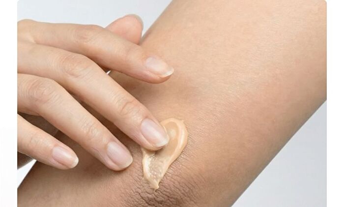 Active Urea Lactic Acid 73000 Cream - 20g