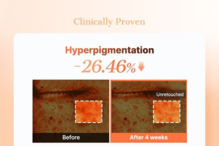 Cosrx 5 PDRN Collagen Vitalizing Hydrogel Eye Patch - 60 patches