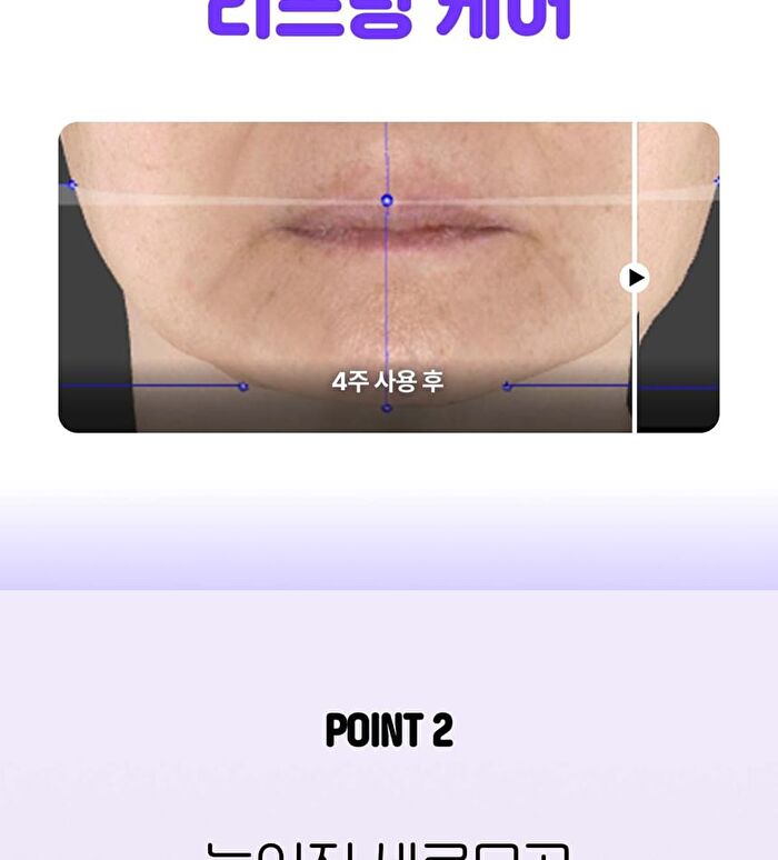 Madeca Teca-Retinolsom 0.2+ Firming Serum - 30ml