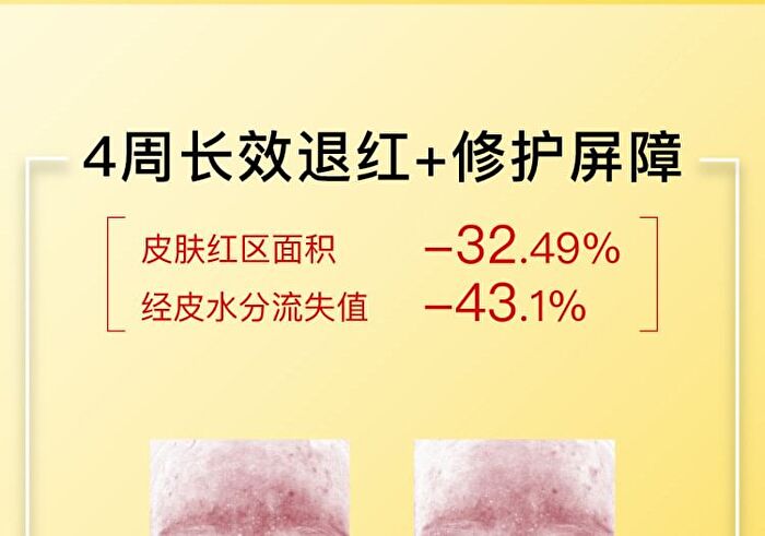 Tranexamic Acid Serum - 3 Sizes - 50ml