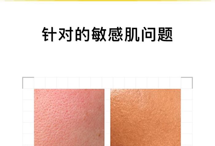 Tranexamic Acid Serum - 3 Sizes - 50ml