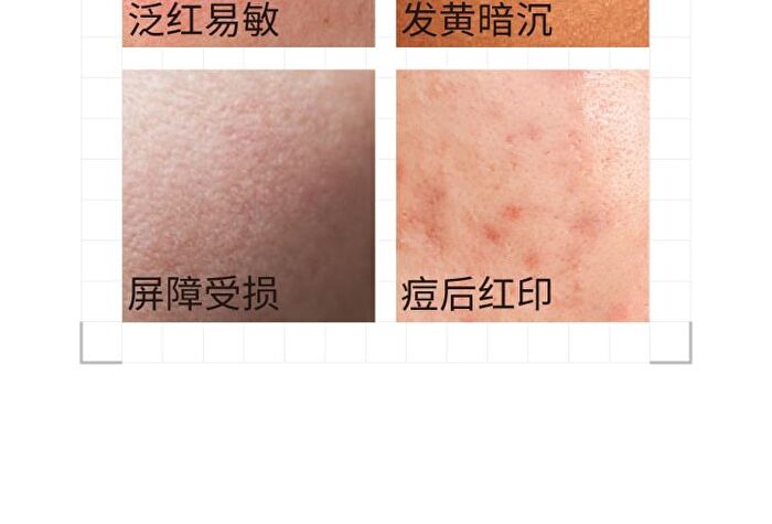Tranexamic Acid Serum - 3 Sizes - 50ml