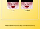 Tranexamic Acid Serum - 3 Sizes - 50ml